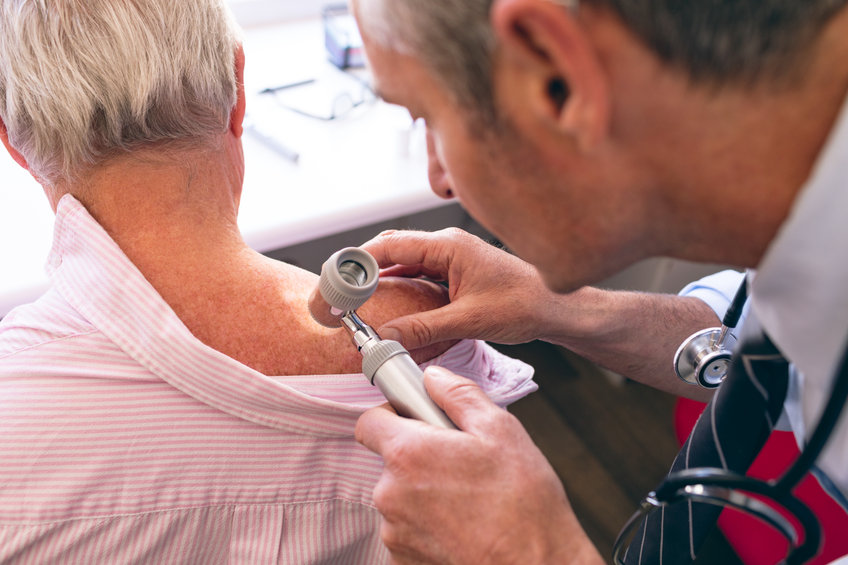 doctor examining patient for skin cancer