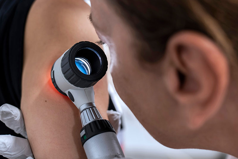 dermatologist examines birthmarks on the patient's skin with a dermatoscope